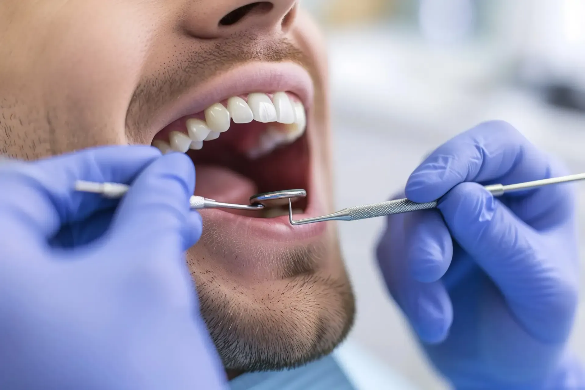 El dentista examina los dientes del paciente con instrumental dental. El paciente tiene la boca abierta. 