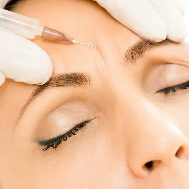 Una mujer recibe una inyección de botox en la frente.