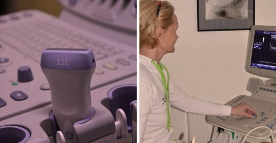 Ultraschallgerät und Durchführen einer Ultraschallaufnahme