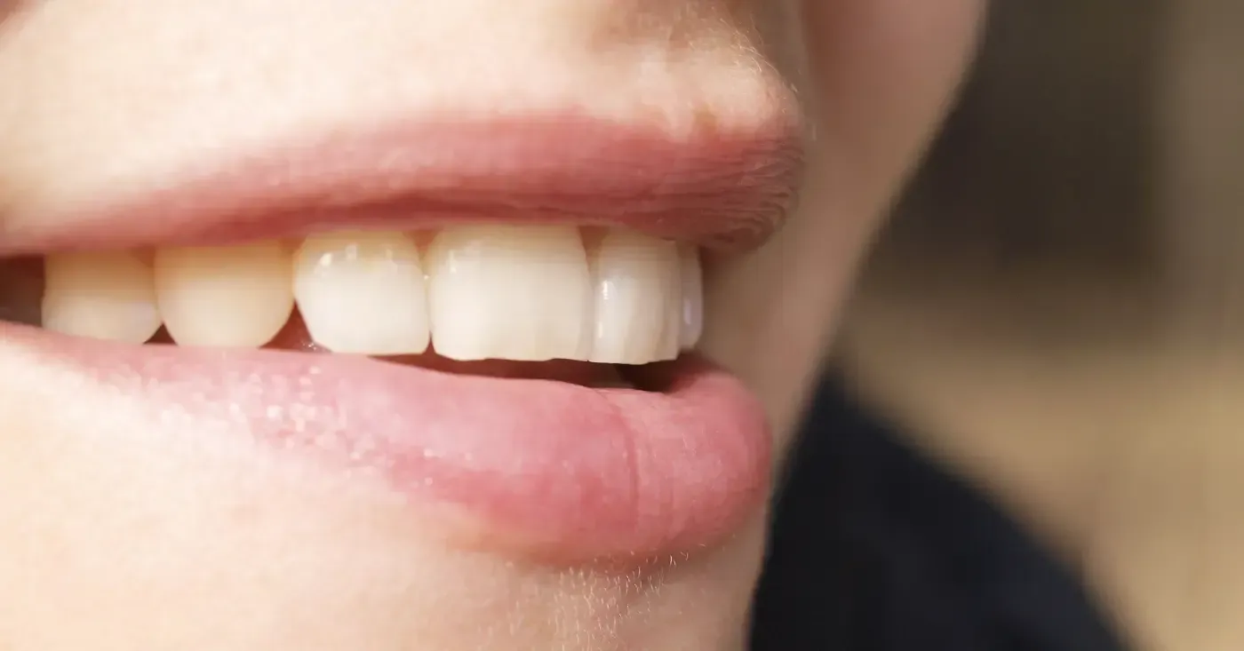 Nahaufnahme eines lächelnden Mundes mit weißen Zähnen und rosigen Lippen