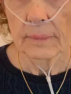 Respir@Home - Noville