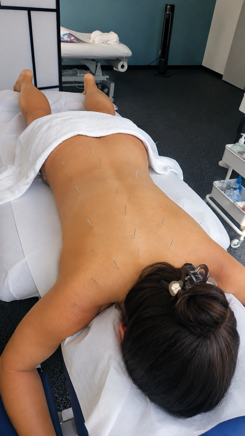 Schröpftherapie Behandlung am Rücken - traditionelle Heilmethode
