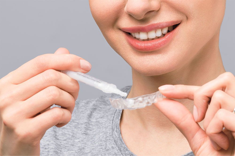 Homebleaching, das professionelle Zahnaufhellungsverfahren Homebleaching, das professionelle Zahnaufhellungsverfahren
