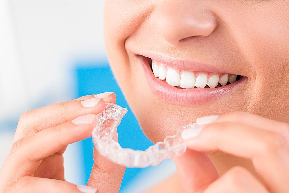 Invisalign Invisalign,