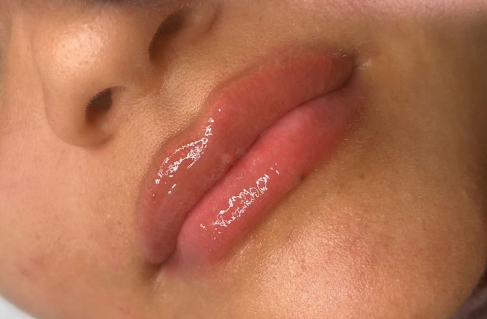 Primer plano de labios con brillo labial brillante, ocultando parcialmente la nariz y la cara.