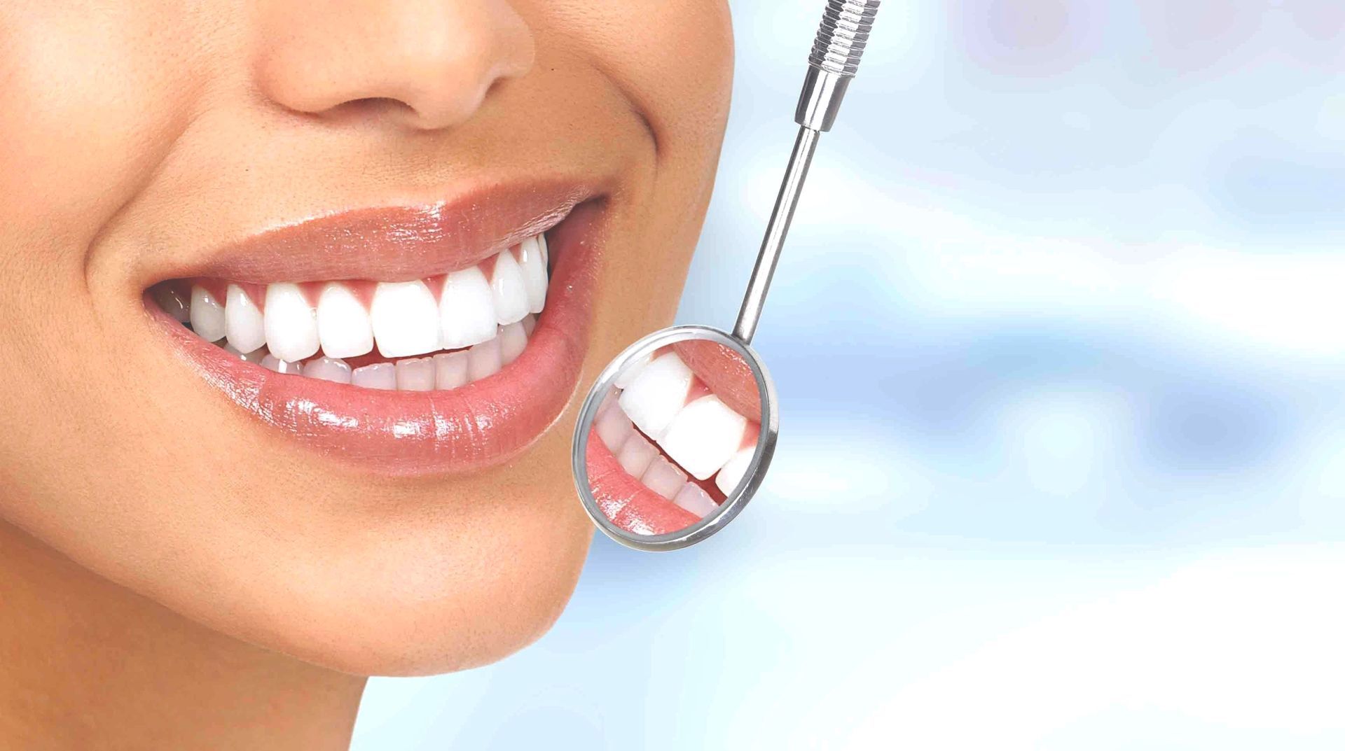 Lumineers - Faccette ultra sottili per ripristinare la forma e il colore desiderato