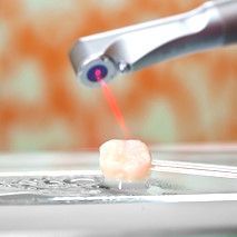 Trattamenti con Laser - Un'opportunità eccellente per i pazienti!