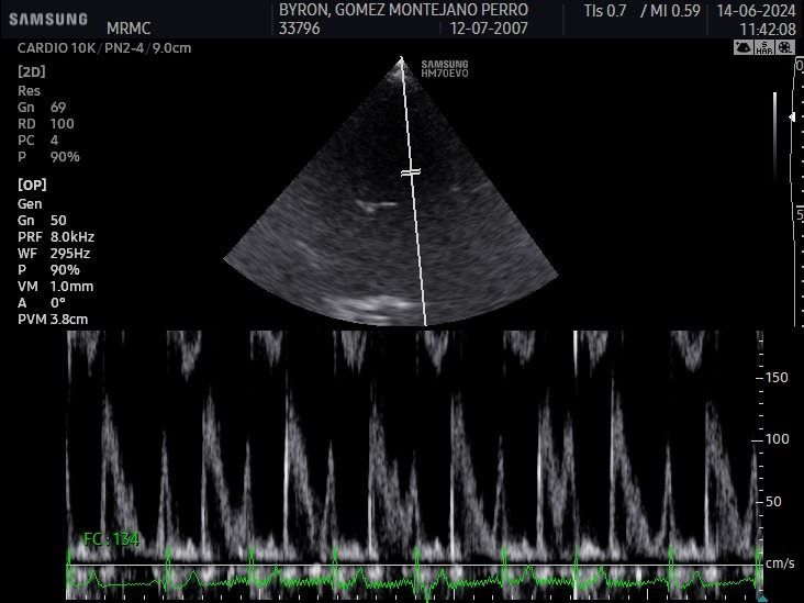 Una imagen en blanco y negro de un dispositivo Samsung
