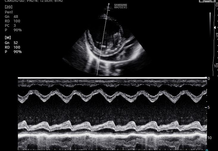 Una imagen en blanco y negro de una ecografía de un corazón.