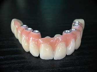 Laboratoire dentaire Bernard Tornare
