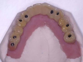 Laboratoire dentaire Bernard Tornare
