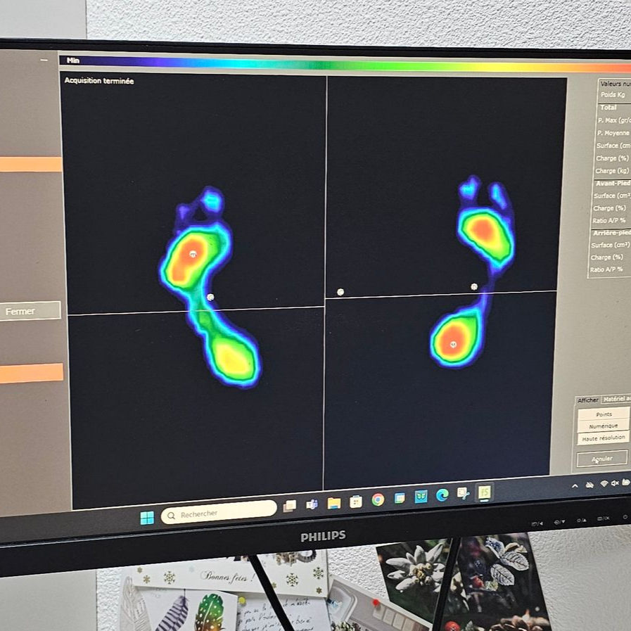 Des empreintes de pieds représentées sur un écran d'ordinateur à la suite d'un bilan postural.