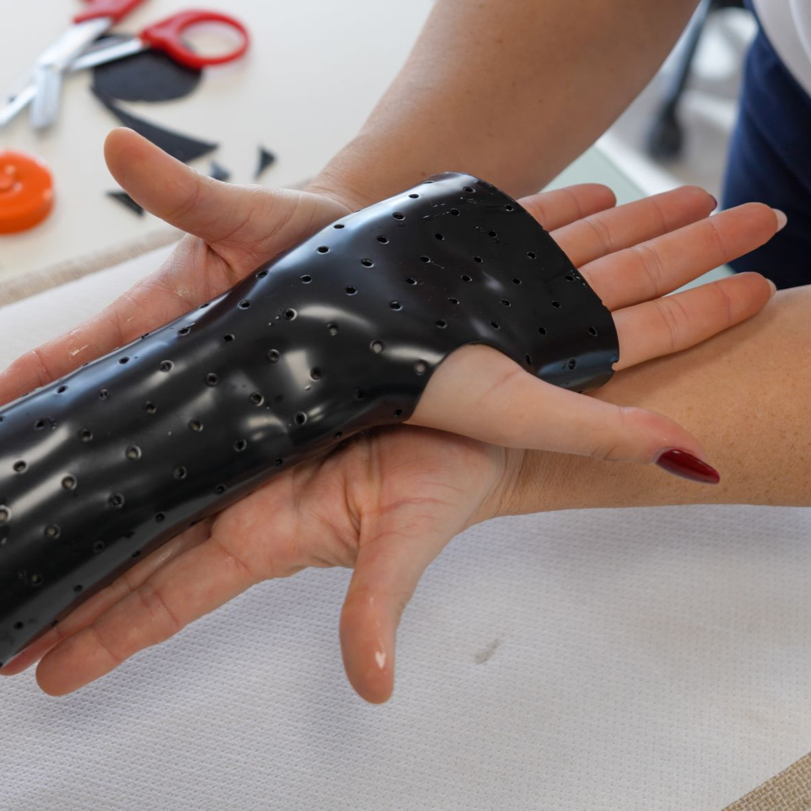 Une attelle thermoformée de main ajustée sur un patient.