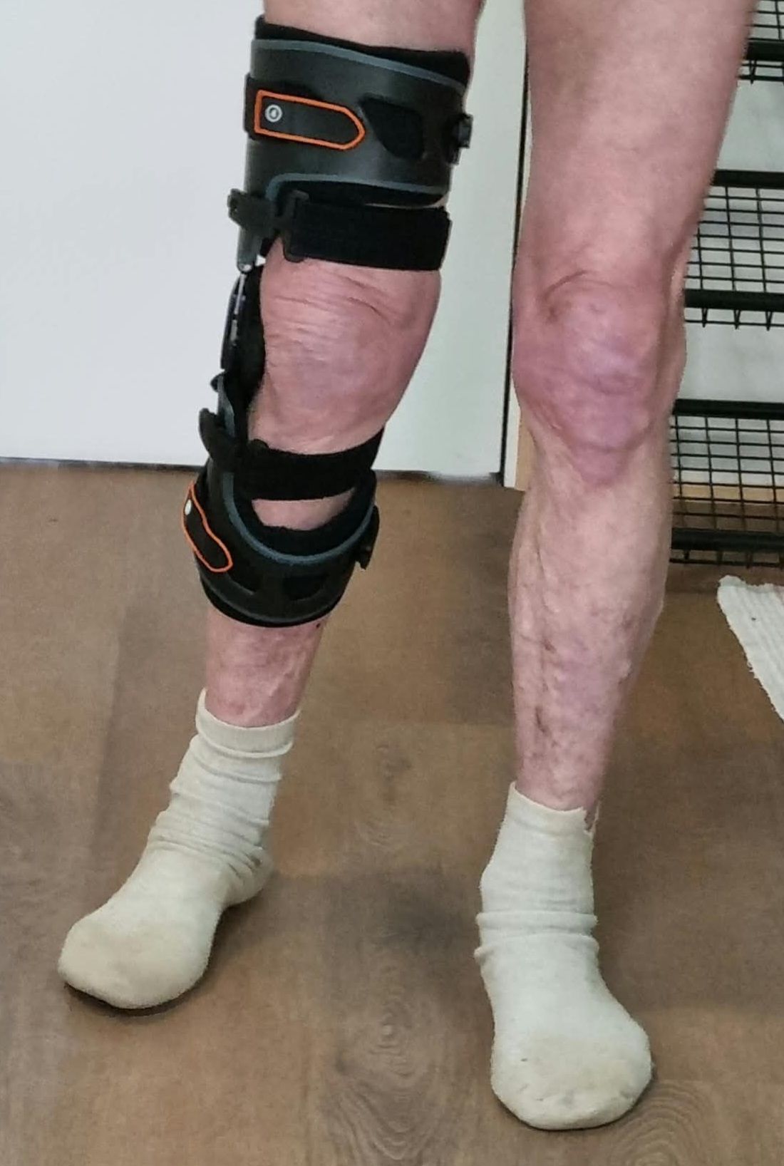 Une personne portant une genouillère.