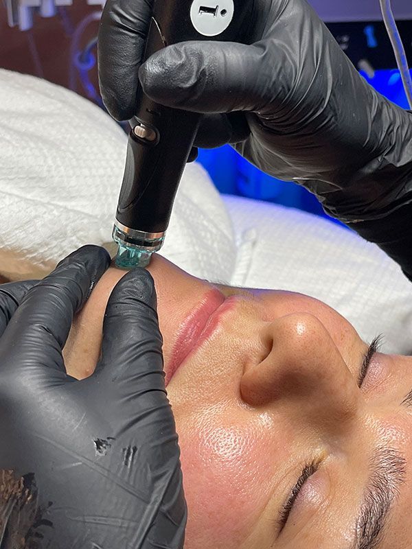 Eine Frau bekommt eine Gesichtsbehandlung mit einem Gerät.