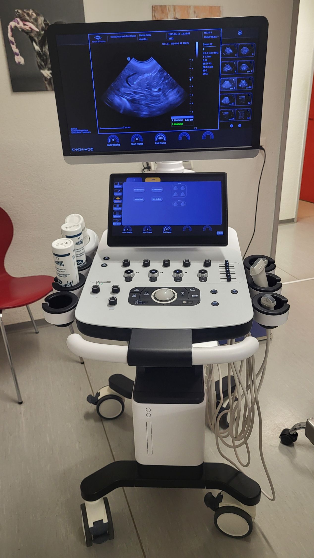 Ultraschallgerät inklusive Doppler