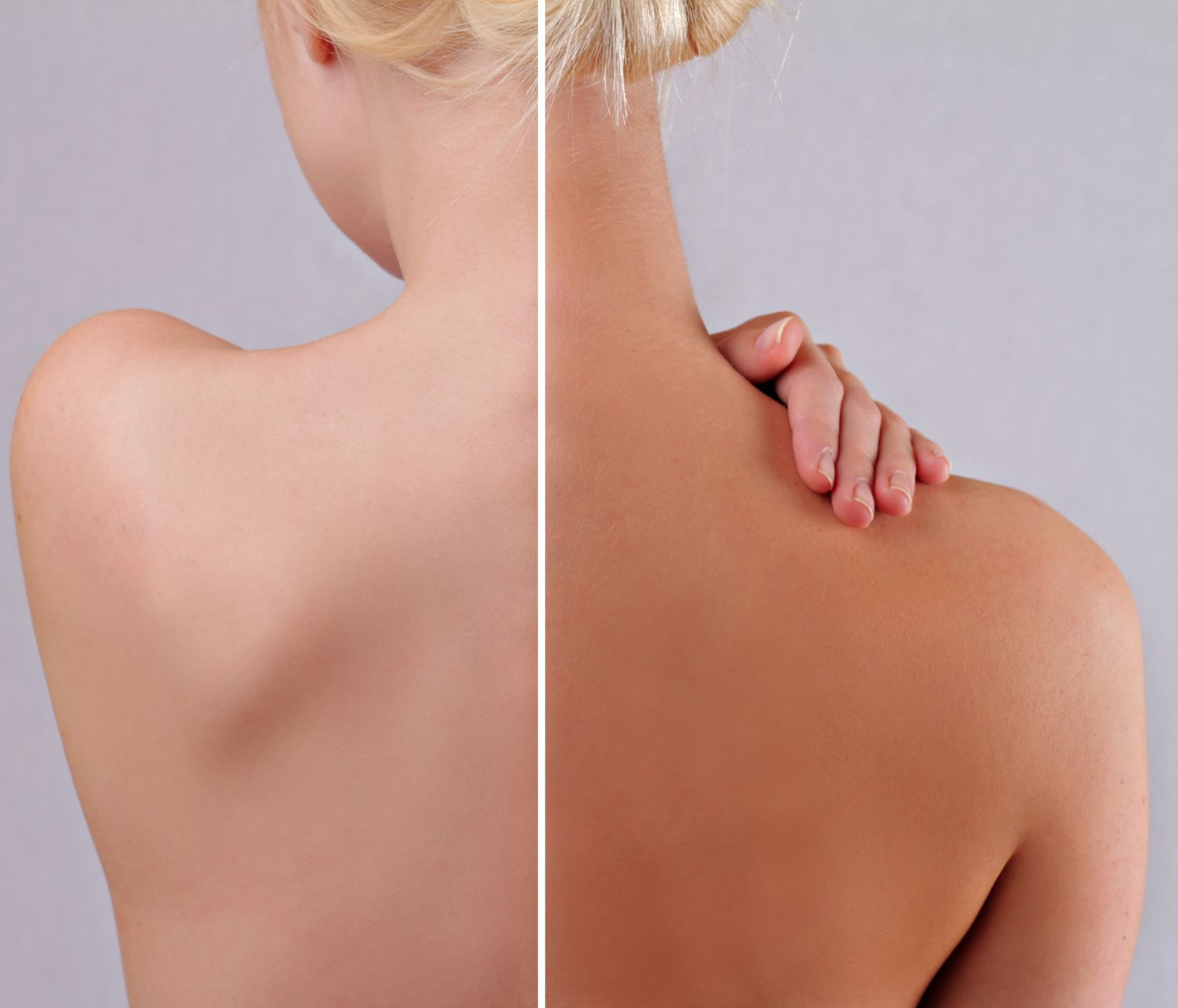 Une femme avec un côté bronzé et un côté pas bronzé