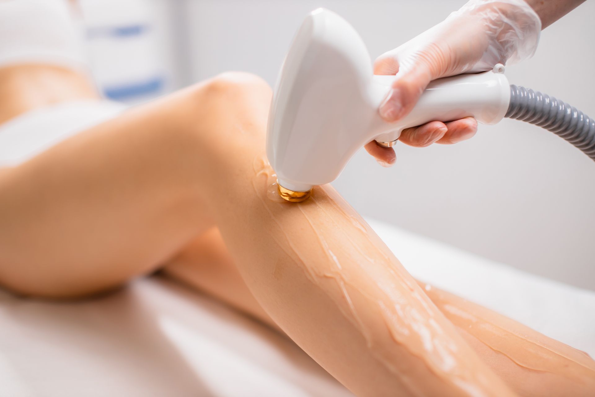 Eine Hand, die einen durchsichtigen Handschuh trägt, bedient ein Laser-Haarentfernungsgerät an einem Bein, das mit durchsichtigem, leitfähigem Gel bedeckt ist.