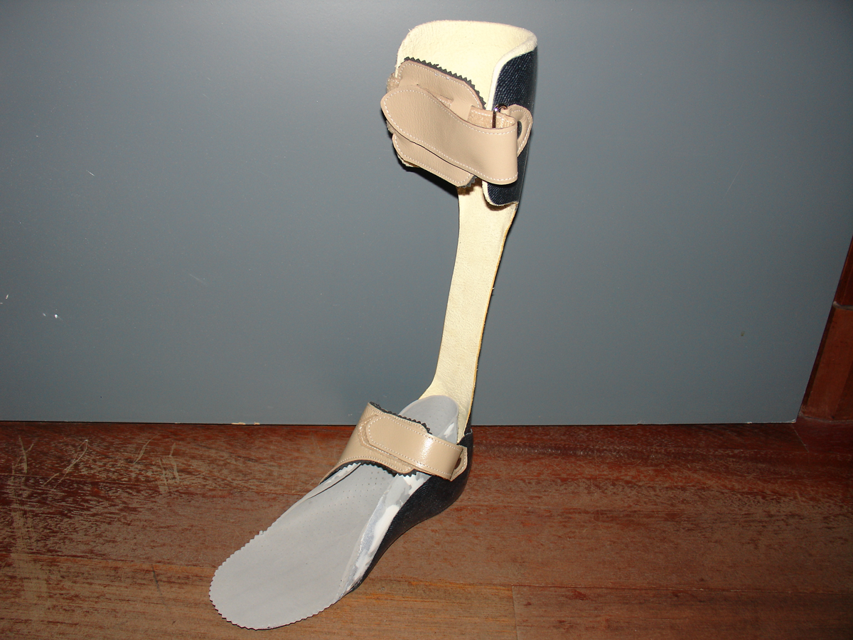 Attelle tibiale fabriquée aux Établissements Milioni