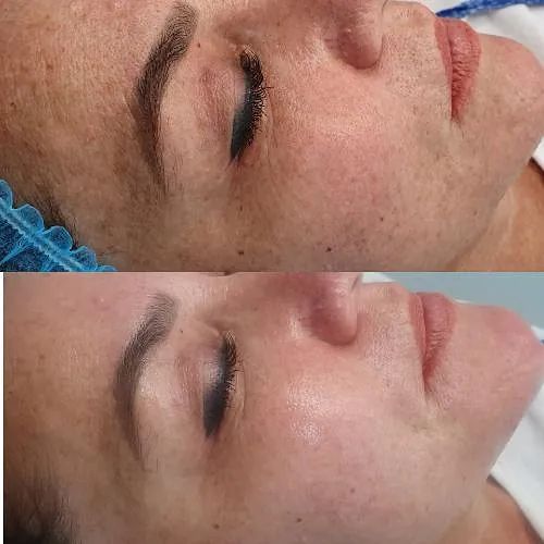 Un primer plano del ojo de una mujer con una máscara.