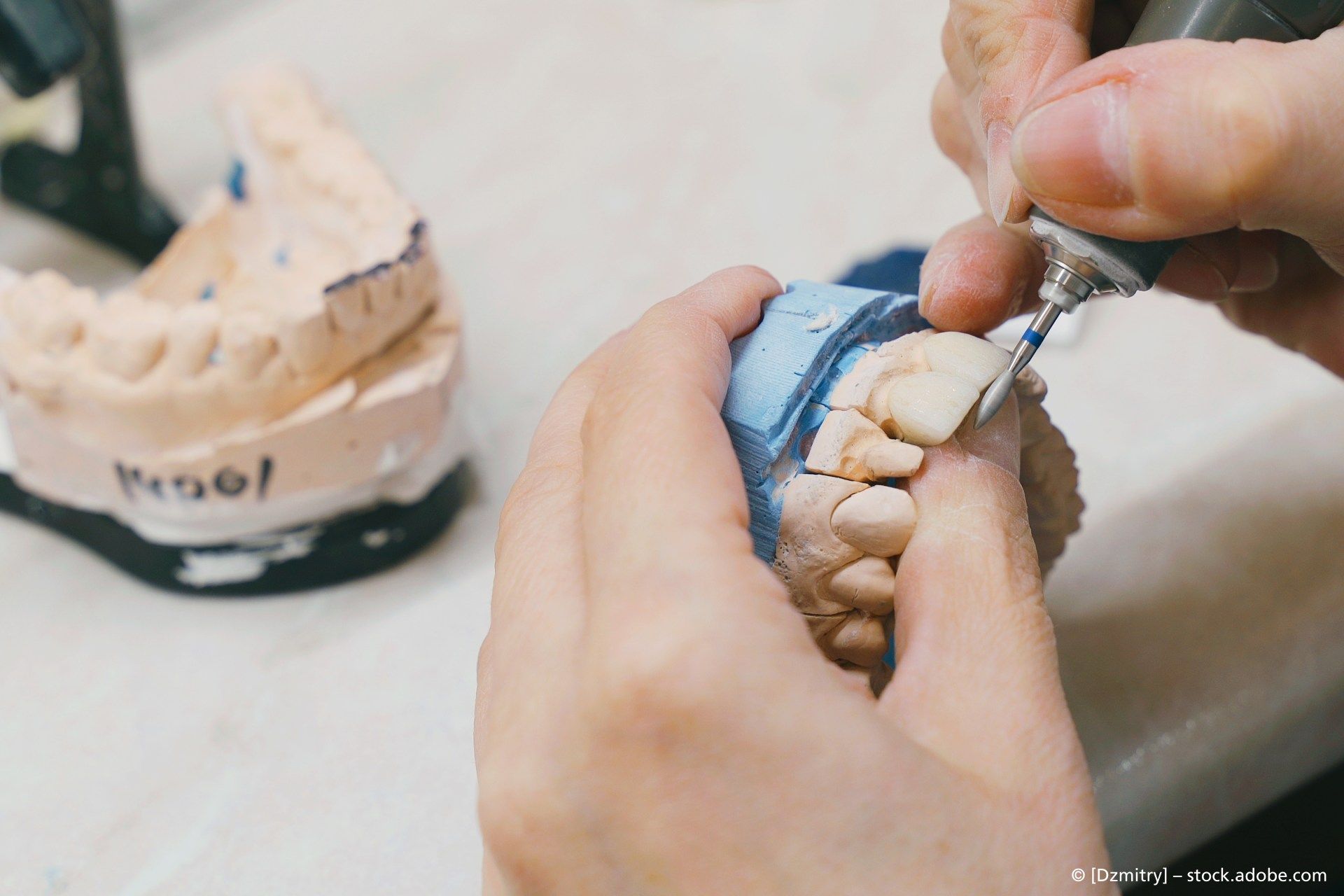 Hände, die ein rotierendes Werkzeug verwenden, um ein Gipszahnmodell zu formen.