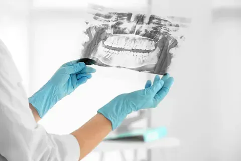 Un dentista sostiene una radiografía de los dientes de un paciente.