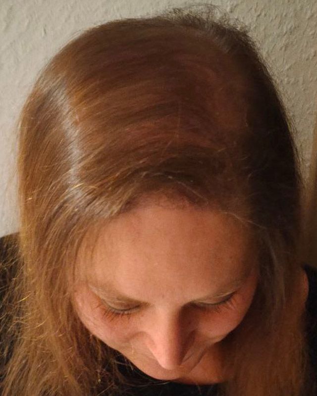 Vorher& nacher bei Patricia
