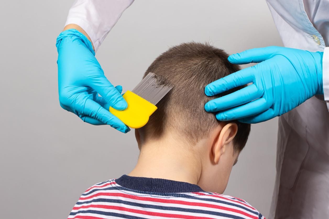 Unas manos enguantadas peinan el cabello de un niño con un peine amarillo para piojos.