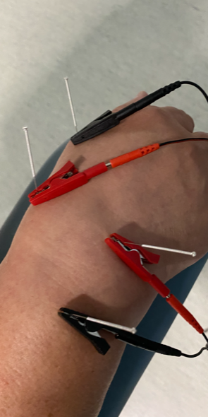 Hirvensalmen Fysioterapia Oy