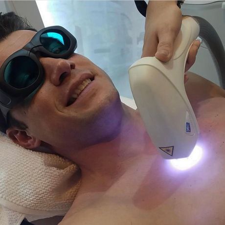 Un hombre que lleva gafas protectoras está recibiendo un tratamiento con láser en el pecho.