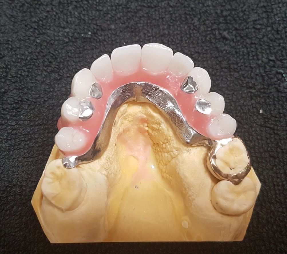 Zähne 7- Hugi Dental