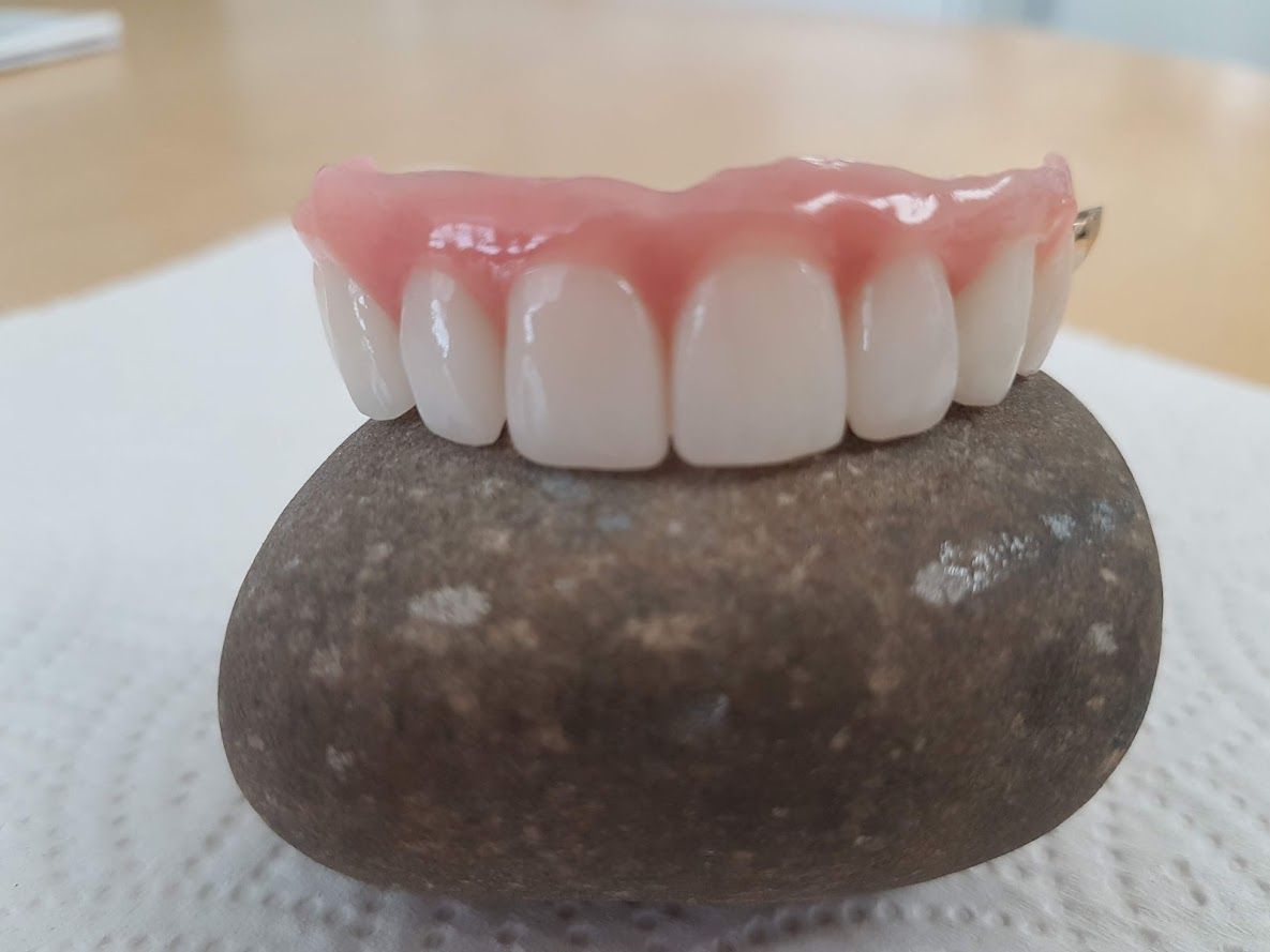 Zähne 3 - Hugi Dental