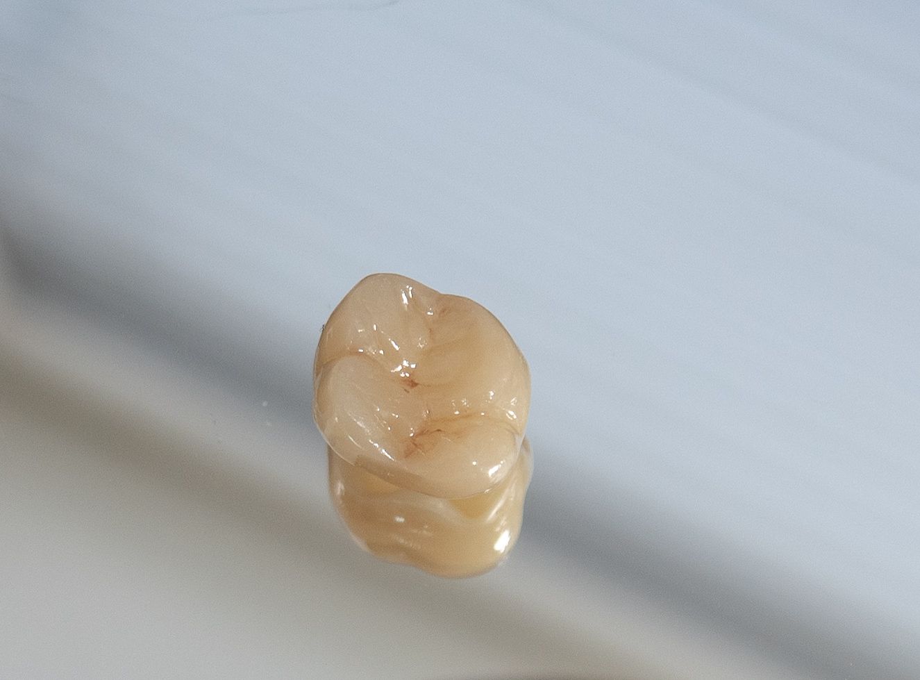 Zähne 5- Hugi Dental