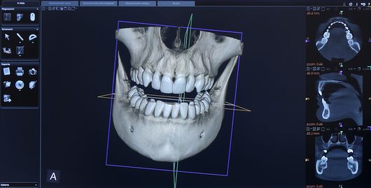Studio Dentistico Malan - Radiografia