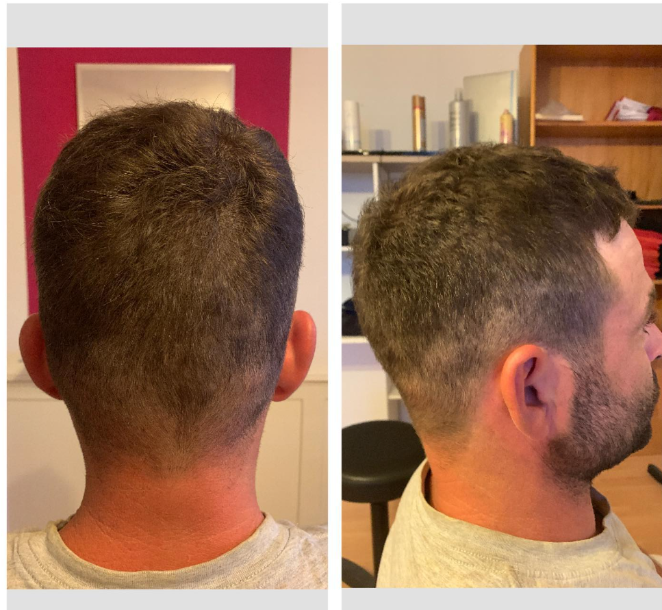 Männerhaar von hinten und von der Seite, mit kurzem, gleichmässigem Haarschnitt.