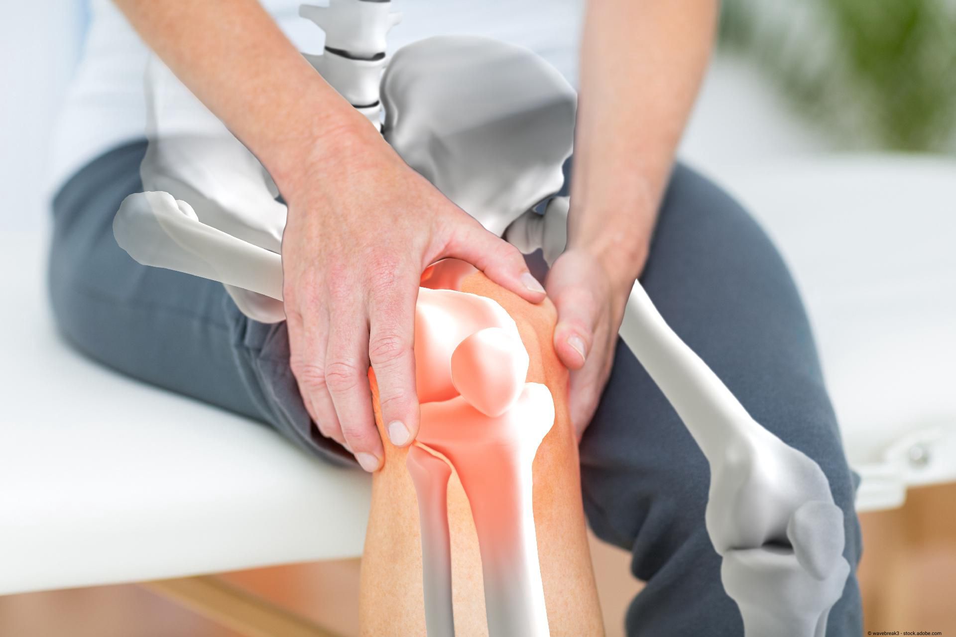 Therapeutische Behandlung eines schmerzenden Kniegelenks mit anatomischem Modell.