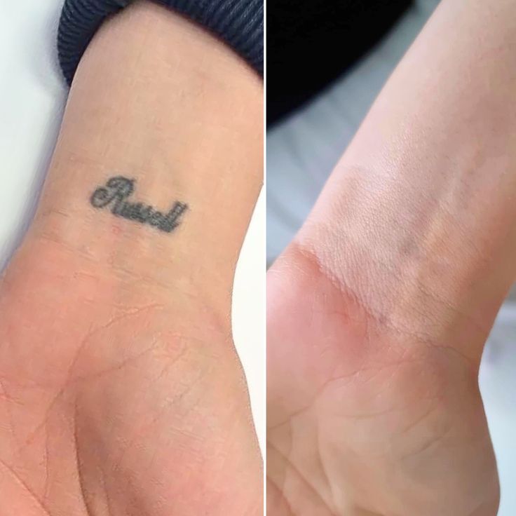 Una mujer se envuelve las piernas con film plástico en un spa.