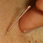 Caroline Syniec : séances d'acupuncture à Sully-sur-Loire