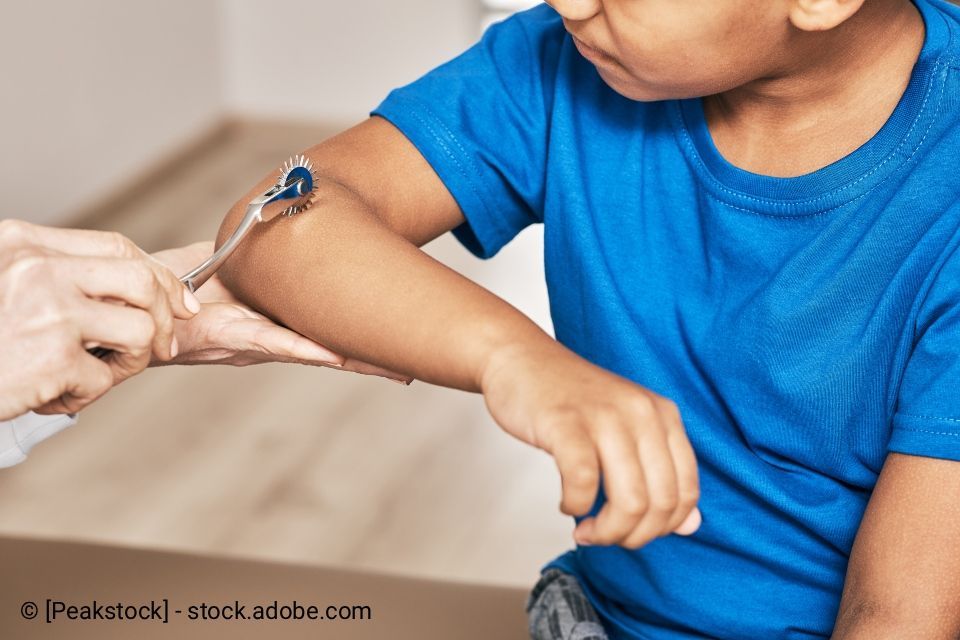 Arzt klopft mit einem Reflexhammer auf den Ellbogen des Kindes.