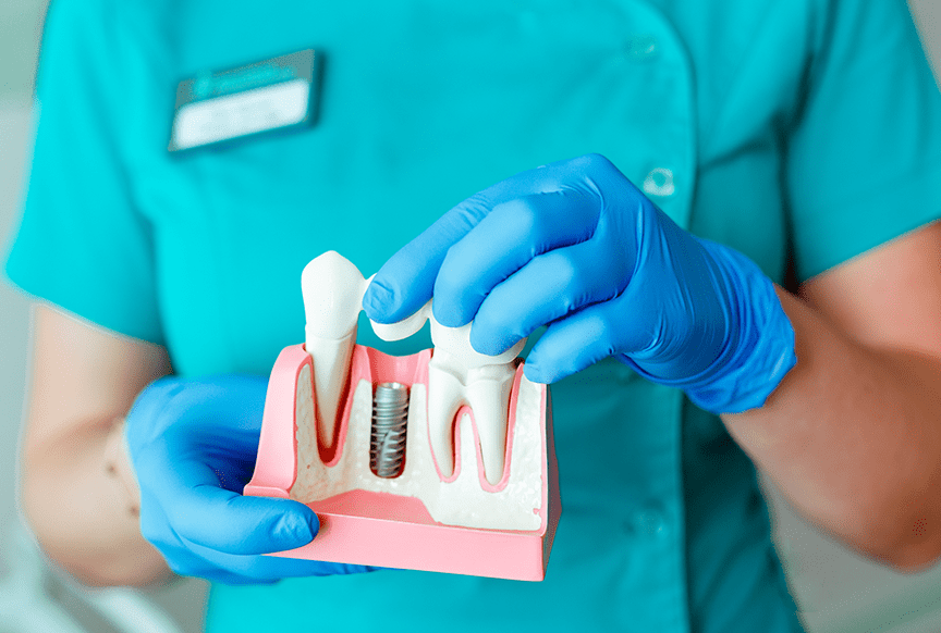 Dentista con guantes azules mostrando un modelo de implante dental sobre una base rosa.