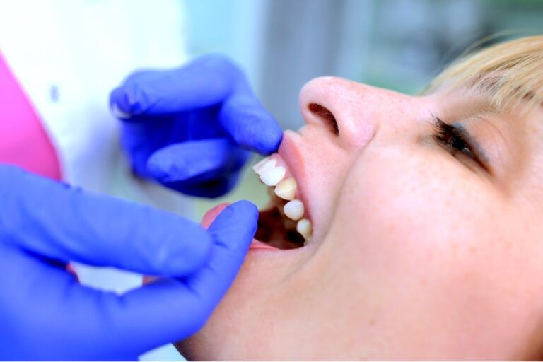 Especialista valorando la colocación de carillas dentales