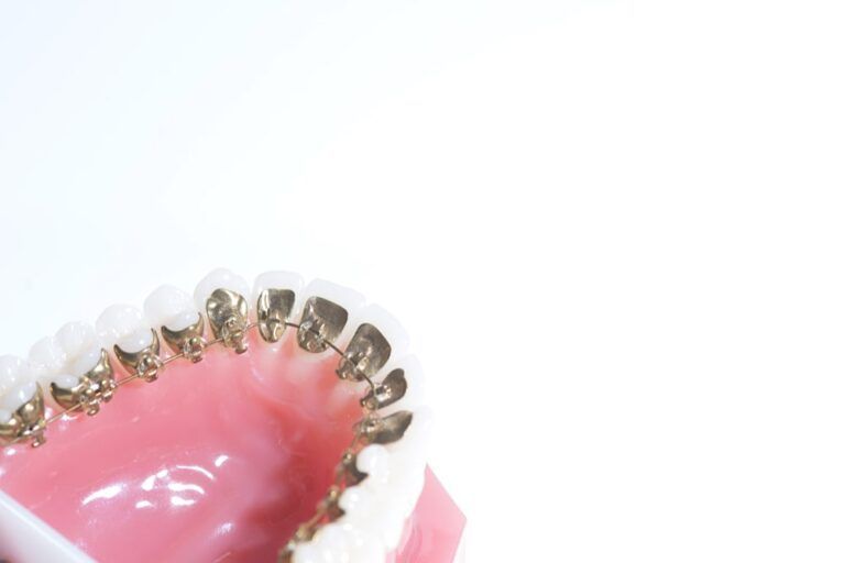Tratamiento de ortodoncia con brackets estéticos