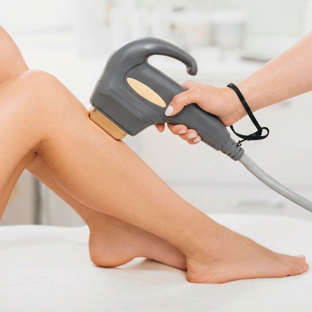Eliminación del vello de las piernas con un dispositivo láser portátil en la parte inferior de la pierna de una mujer.