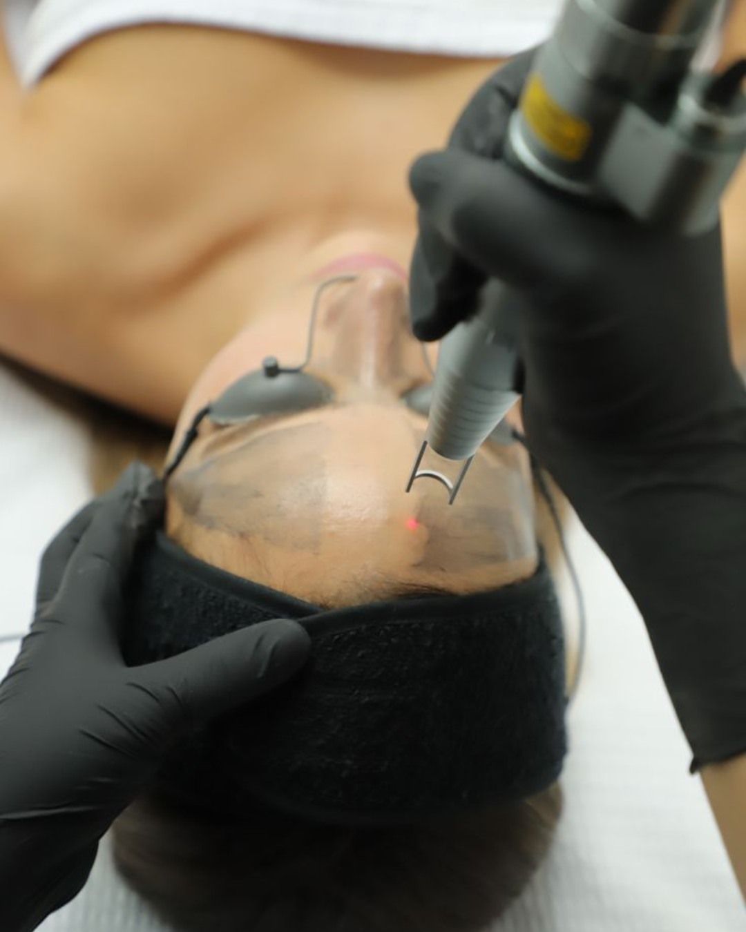 Procedimiento médico utilizando un dispositivo portátil en el rostro de un paciente