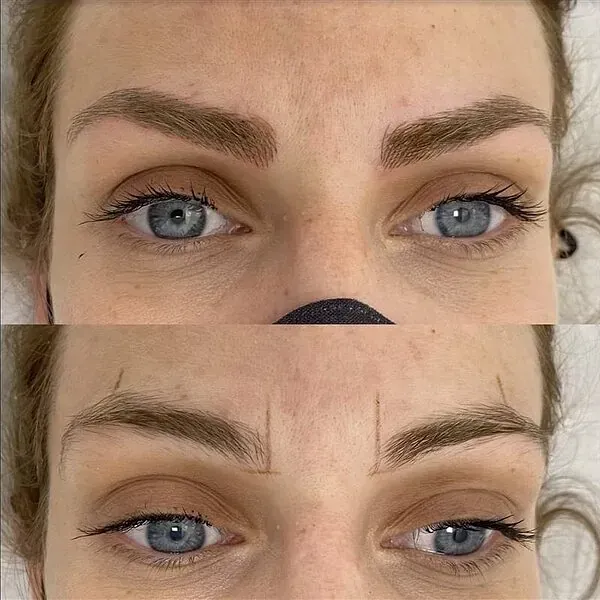 Una fotografía de antes y después de las cejas de una mujer.