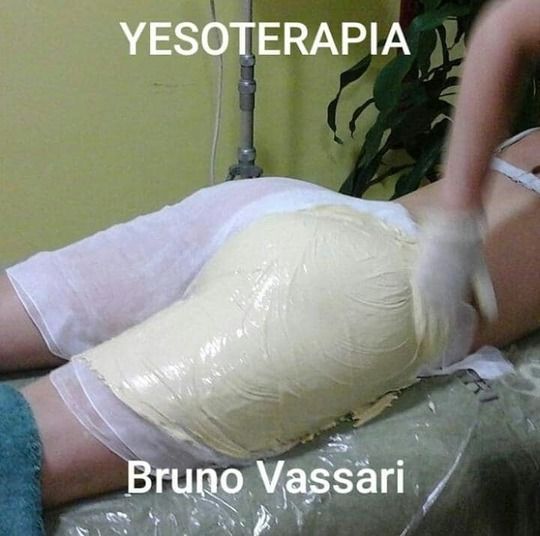 Una mujer recibe un tratamiento de yesoterapia con Bruno Vassari.
