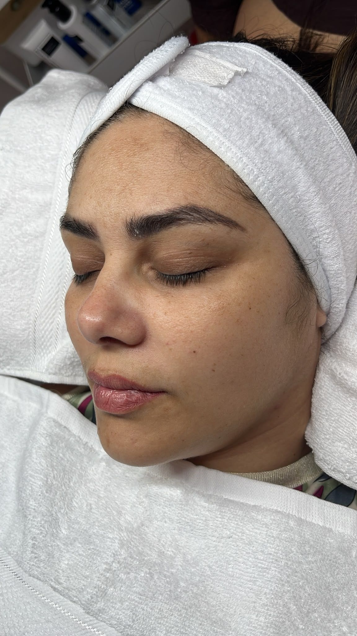 Mujer tumbada en una camilla con un pañuelo blanco en la cabeza, con los ojos cerrados durante un procedimiento facial.