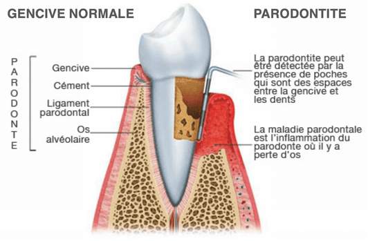 Parodontie - Cabinet médicaux dentaire Places St- François
