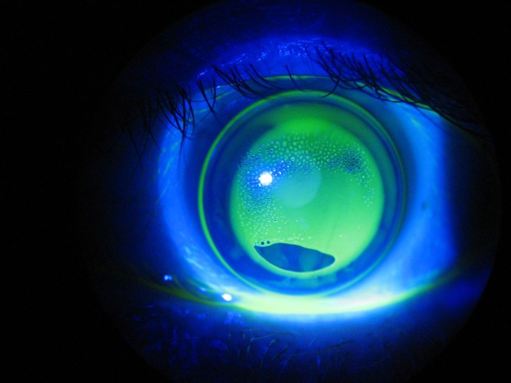 Un primer plano del ojo de una persona con una luz azul brillando a través de él.