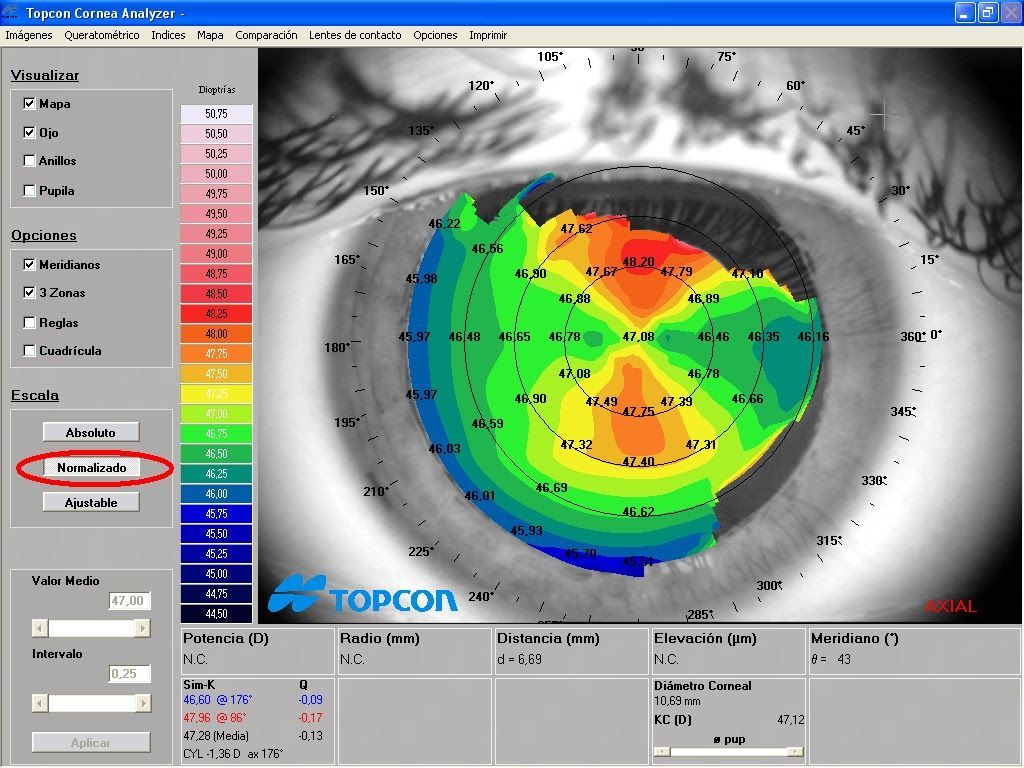Una pantalla de computadora con un logotipo de Topcon.